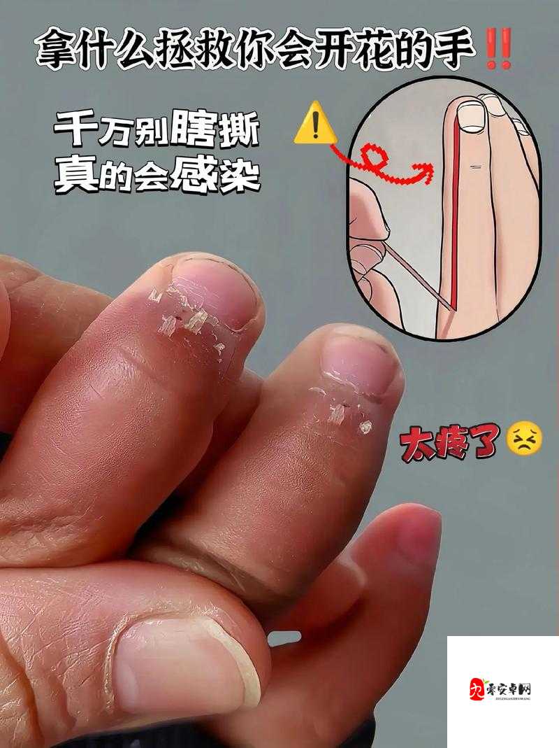 才一根手指头就喊疼是什么意思:是缺乏锻炼还是真的疼?